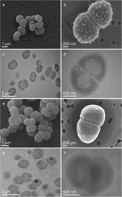 бактерия Deinococcus radiodurans