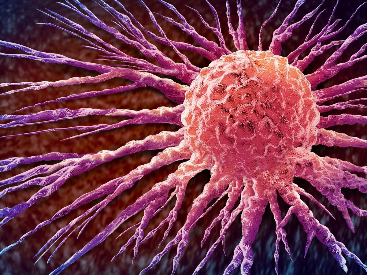    Изображение раковой клетки © iStock.com / wildpixel