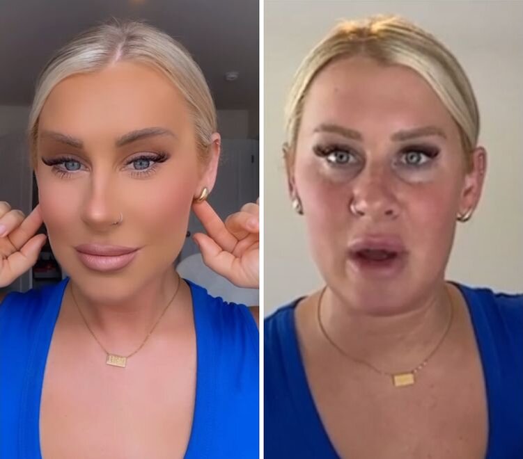 Источник: https://www.reddit.com/r/Instagramreality/comments/13p08om/she_says_she_uses_filters_just_to_color_correct