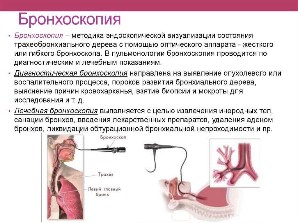 Утренний туалет бронхов