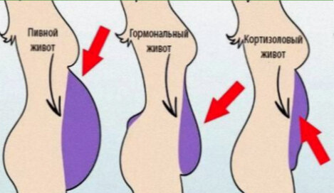 Как снизить уровень кортизола, чтобы жить дольше и счастливее