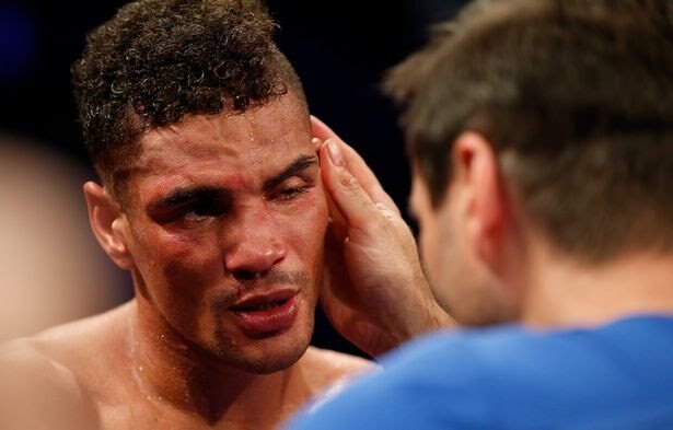 Источник: https://www.google.ru/amp/s/www.mirror.co.uk/sport/boxing/breaking-anthony-ogogo-retires-boxing-14117851.amp
