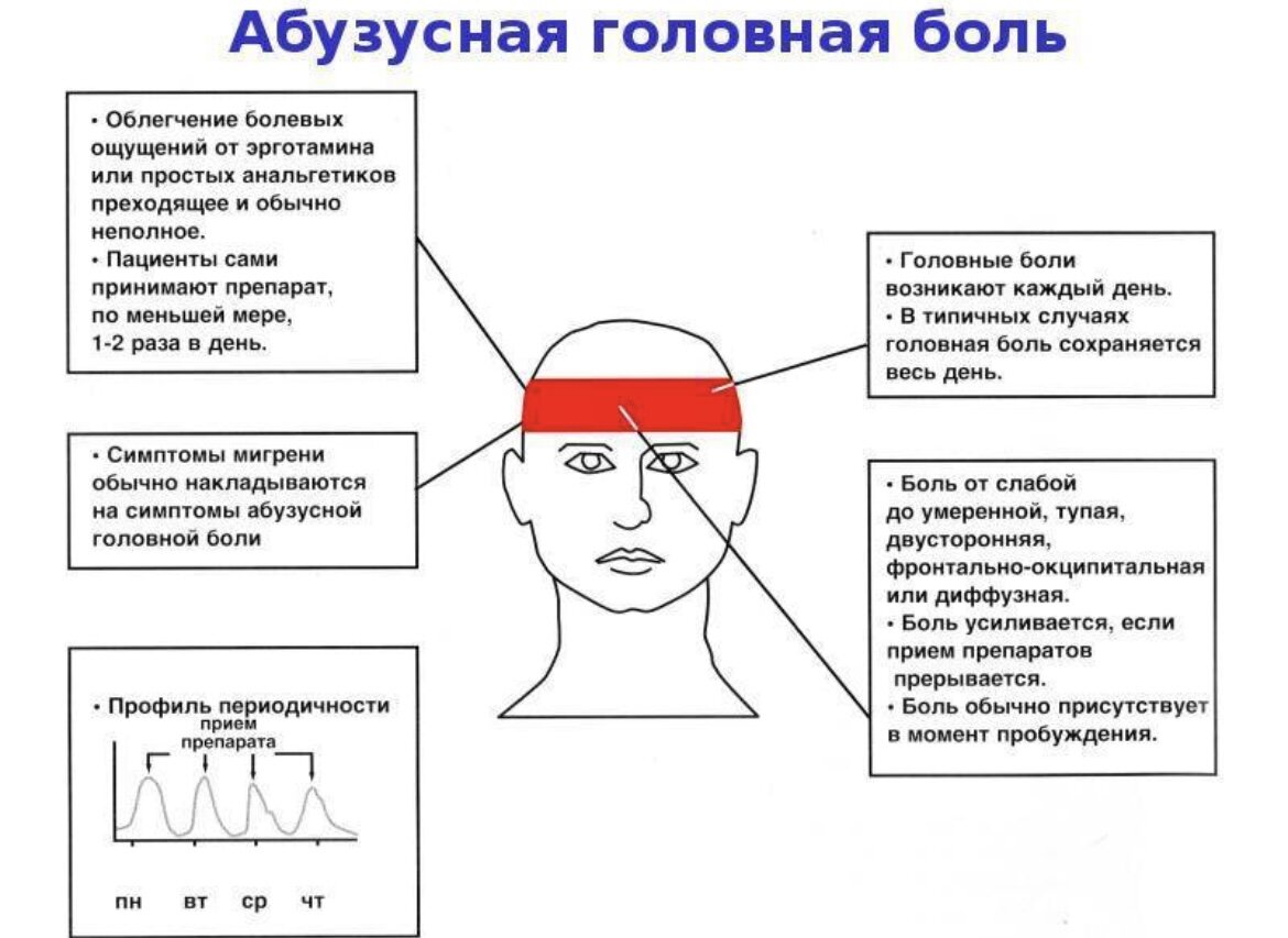 Голова болит машин