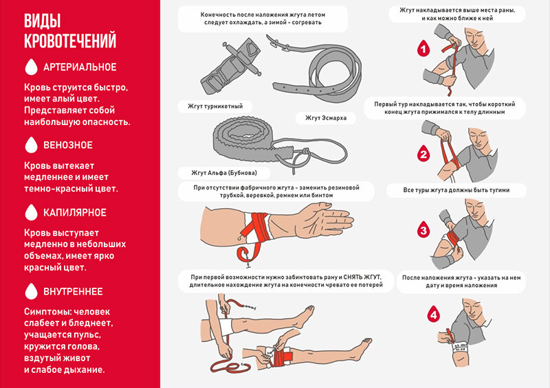 Оказание первой помощи при кровотечениях