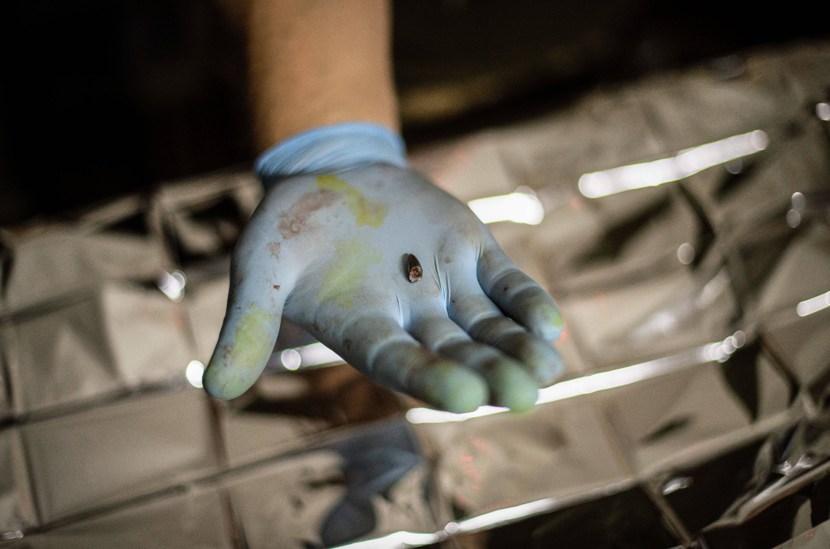 Из раны украинского солдата извлечена пуля © IMAGO/ZUMA Wire