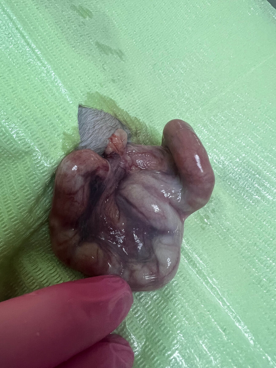 Матка заполненная гнойным содержимым