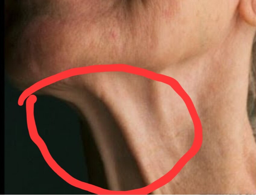  У кого еще до 48  нет, напрягите шею и потрогайте пальцами. Кожа? Кожа.