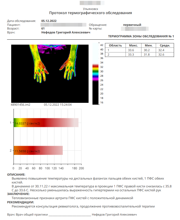 Результаты того же пациента, полученные на второй неделе назначения специфической терапии. Можно отметить снижение температуры над пораженными суставами, что свидетельствует об эффективности назначенных препаратов. Причем данные проведенного исследования соответствуют «традиционным» критериям оценки эффективности лечения - пациенту стало лучше, а показатели крови показали снижение активности воспалительного процесса