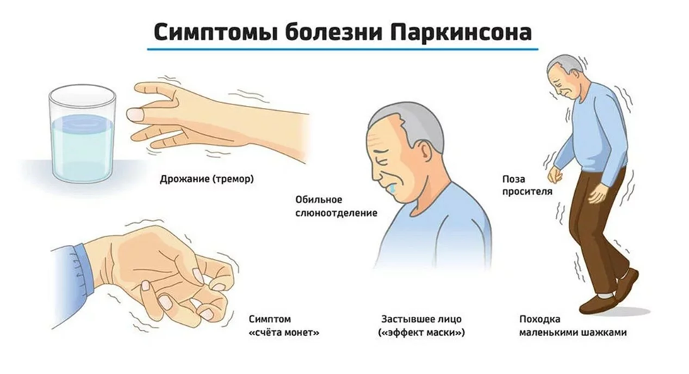 Тремор рук. Виды тремора, диагностика и лечение.