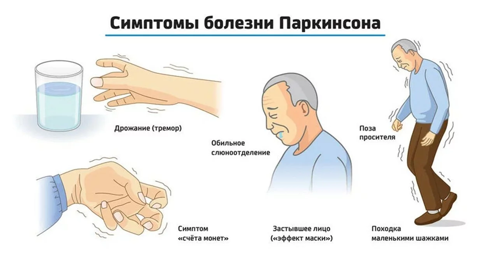 Тремор - Тремор - Справочник MSD Версия для потребителей