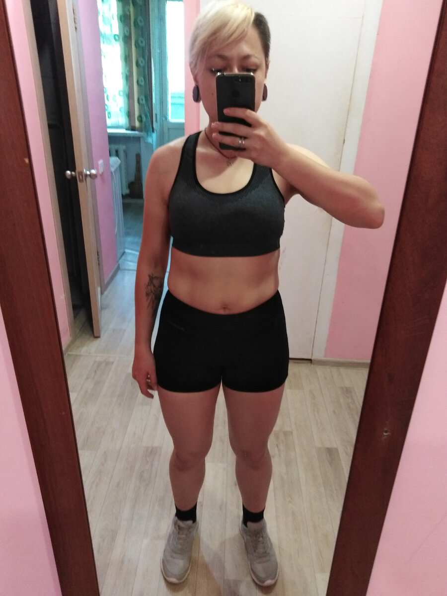 Ангелина Буваева, тренер-диетолог. Похудела с гипотиреозом на 30 кг. Фото отеков при гипотиреозе через 1,5–2 месяца после операции.