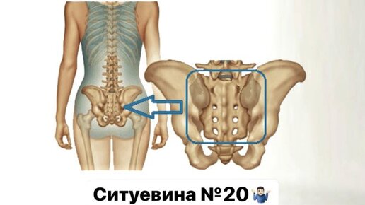 Крестец это где фото