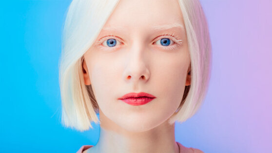    Какой сегодня праздник: 13 июня – День распространения информации об альбинизме Даниил Шалонников