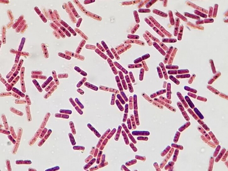 Фотография кишечной палочки (Escherichia coli). Источник: https://artembolnica2.ru/virusy/v-kozem-moloke-mozhet-byt-kishechnaya-palochka.html