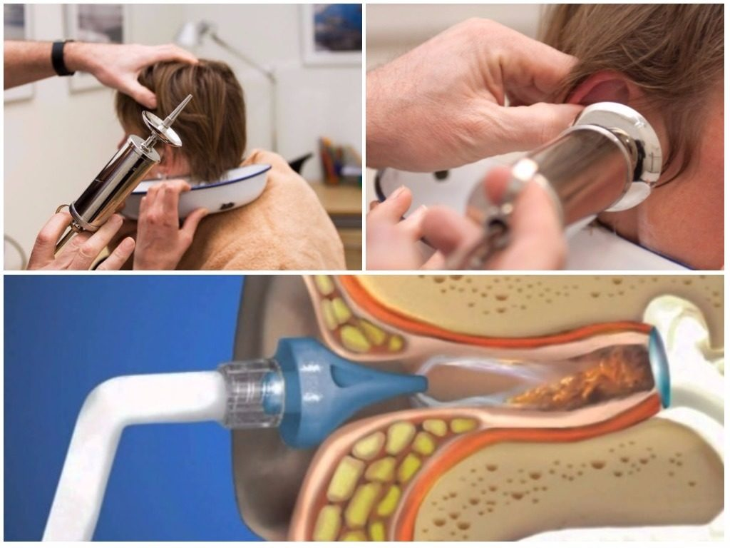 ванна при отите