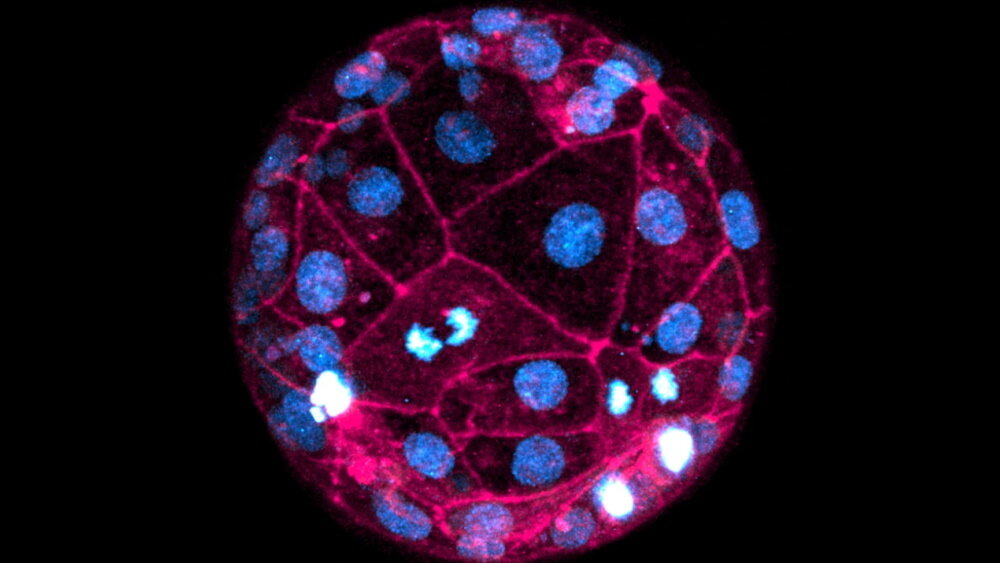    Фото: Robin M. Skory, Ana Domingo-Muelas