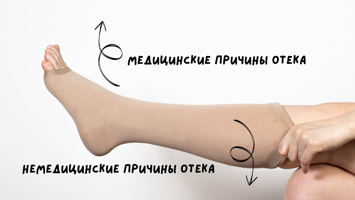 Leg Cramps during Pregnancy: Causes, Symptoms & Remedies Schwangerschaft, Krämpf