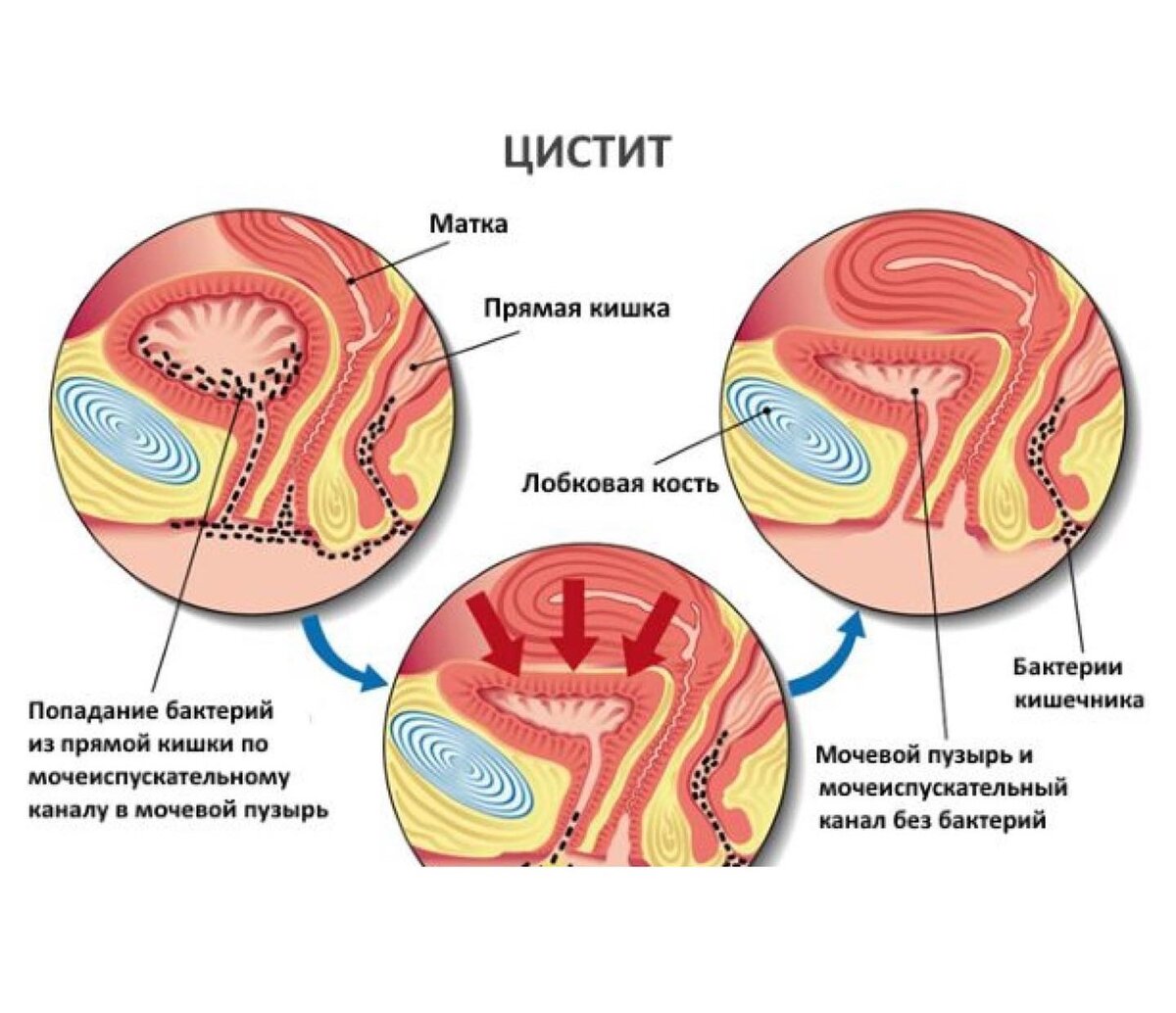Миграция бактерий в норме