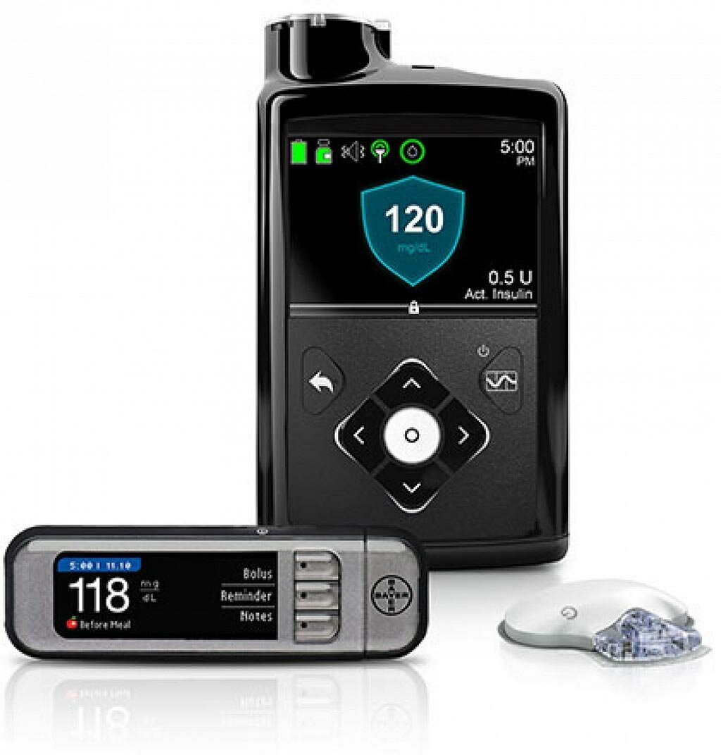 MiniMed Flex Insulin Pump Now Available to Medicare Beneficiaries