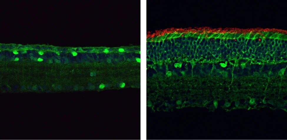 Зрение мыши. Терапия стволовыми клетками. Пигментный ретинит сетчатки. Исследования в нейробиологии. Зрение при пигментном ретините.