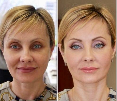 Аккуратный правильный тон. Яндекс.картинки.