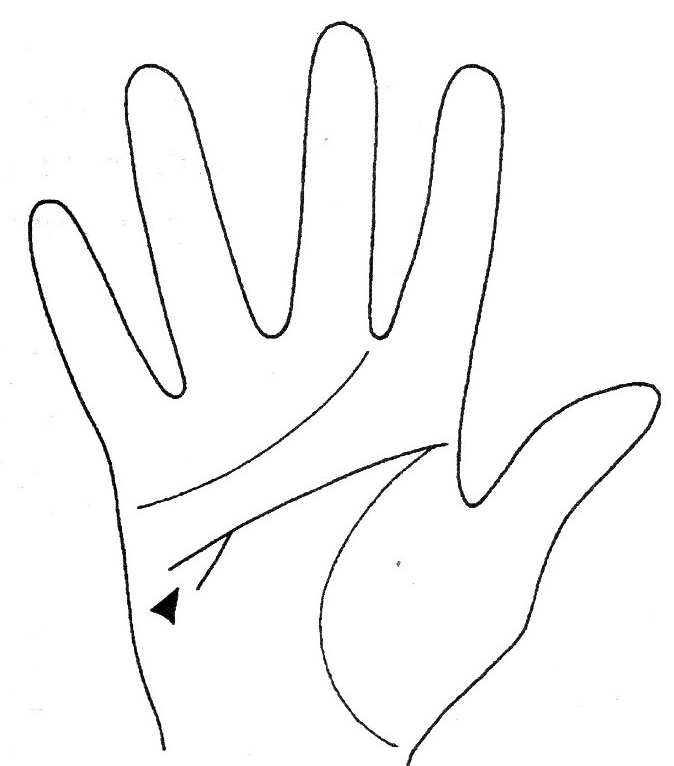 Знак писательская развилка на линии головы