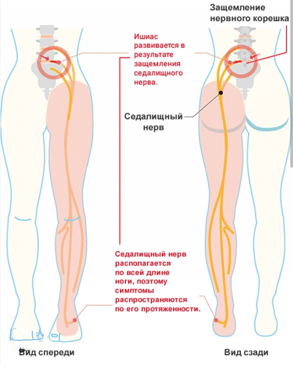 Как проходит седалищный нерв у человека по телу фото