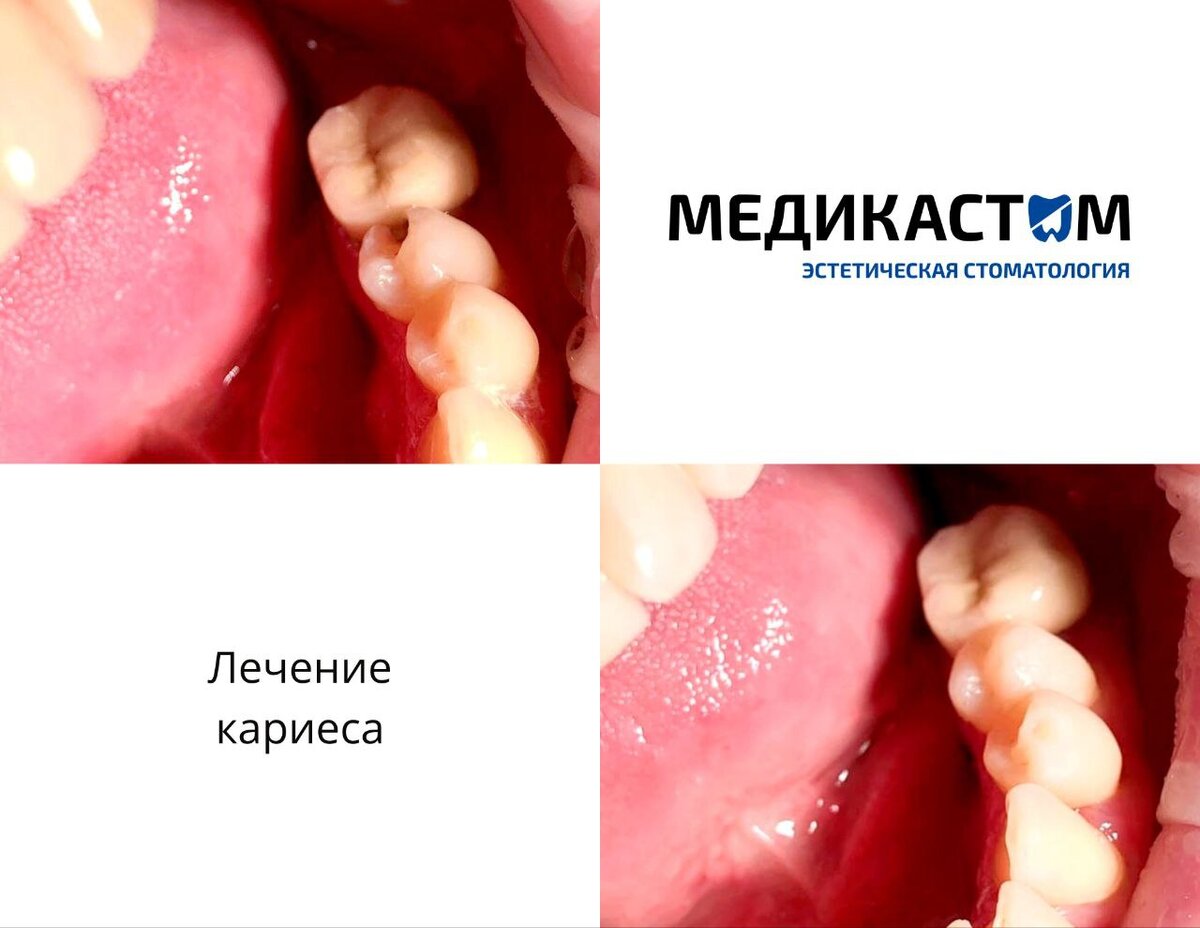 Специалисты «Медикастом» занимаются эффективной профилактикой и лечением многочисленных патологий ротовой полости. 