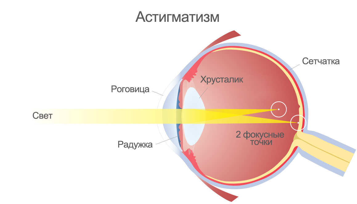 На сетчатке глаза изображение увеличенное