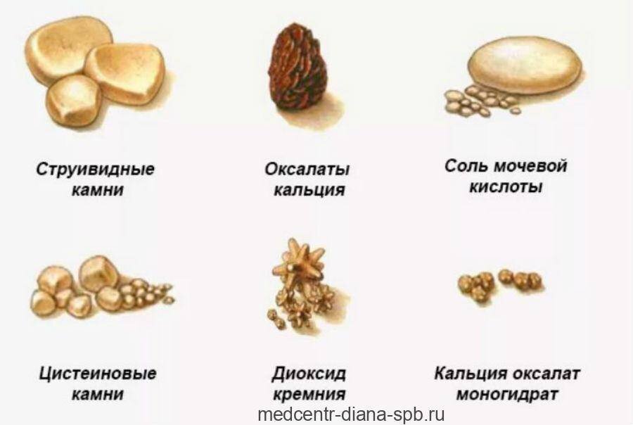 Иллюстрация взята из Яндекс Картинки