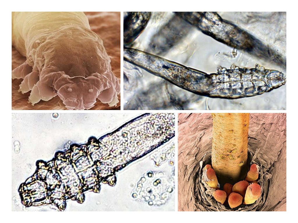 Demodex. Демодекоз (угревая Железница). Клещ демодекс фолликулорум. Клещ Железница (Demodex folliculorum).