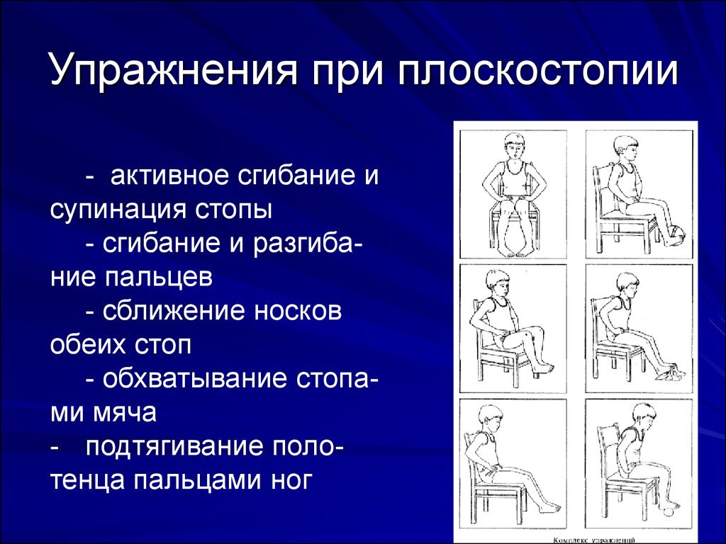 Тренировки при плоскостопии в тренажерном зале