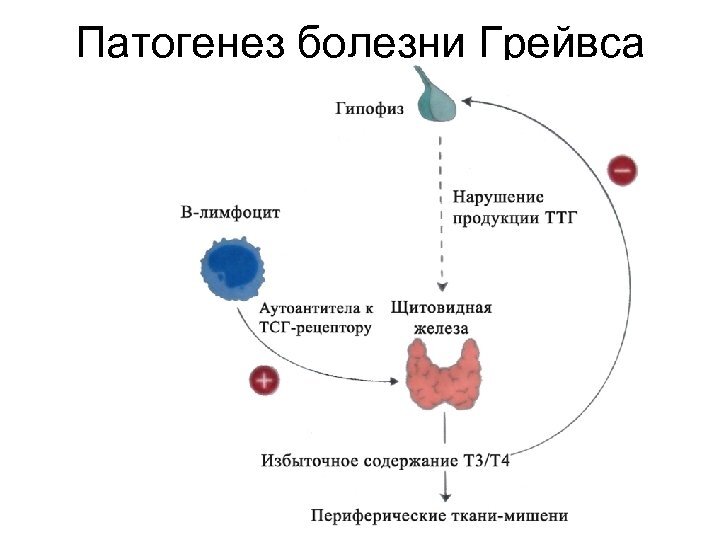 Диффузный токсический зоб: причины, симптомы и лечение