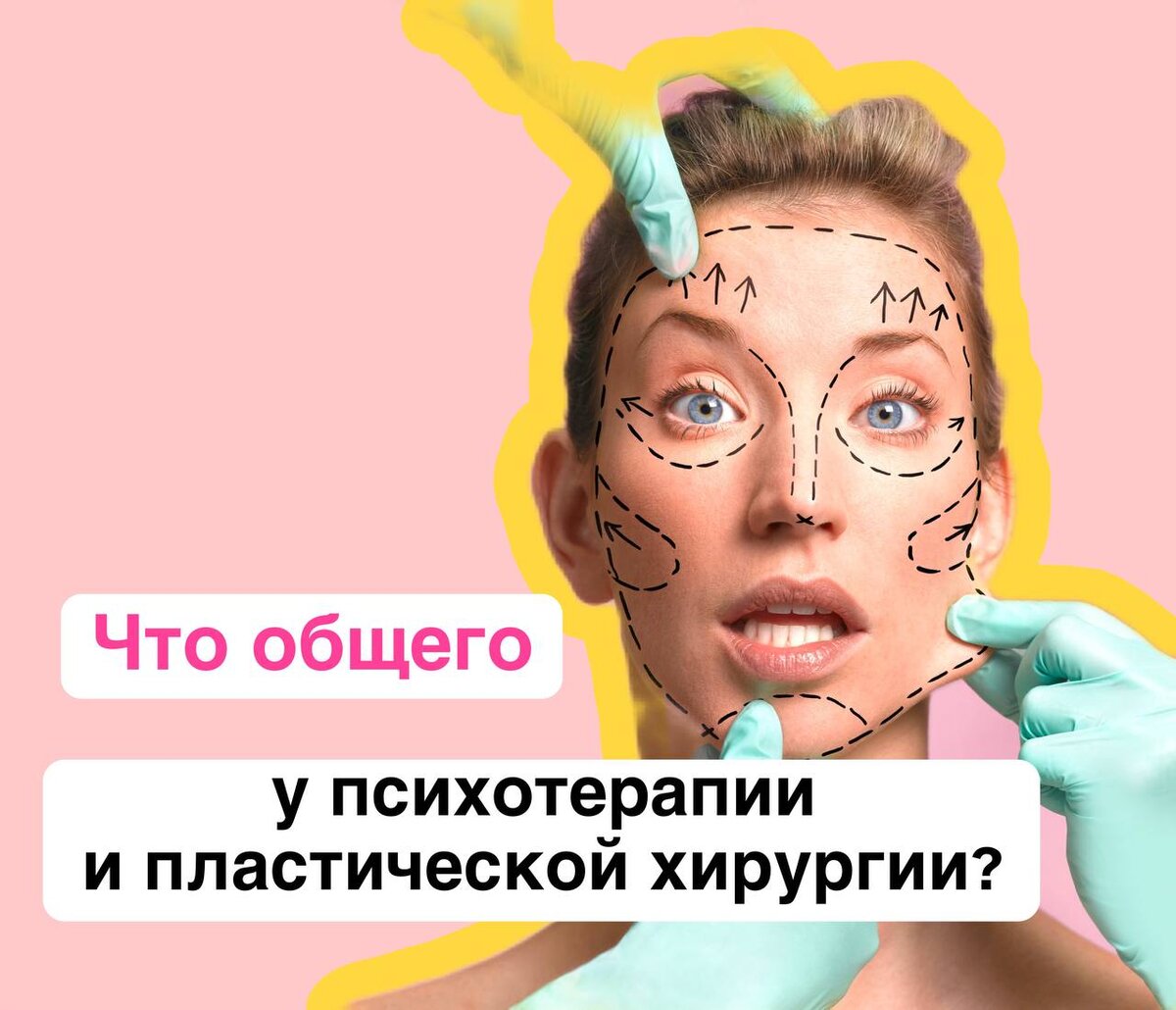 

Если вы думаете, что речь о том, что люди становятся прекраснее и исправляют какие-то природные особенности или те, которые они приобрели с возрастом - это конечно да, но писать буду не об этом сегодня😎 
❕Речь пойдет о гиперкоррекции. 
После пластической операции на лице (СМАС, булхорн, эндоскопическая подтяжка) всегда будешь выглядеть как немного гуманоид, потому что будет казаться, что ткани перетянуты/губы размером с новую Зеландию и ты так и останешься фриком навсегда.

Но время проходит, в процессе реабилитации ткани опускаются на свои места и все становится ОК. Ты становишься красивым и счастливым. 

Вот во время психотерапии я наблюдаю такой же эффект у людей. 

Работаешь с границами - человек начинает так их отстраивать, что вокруг только и летят щепки из близких людей, с вытаращенными от неожиданности глазами.

Работаешь с парой на тему важности близости и совместного времяпрепровождения - они радостно делятся, что уже 2 недели каждый день ходят на свидания и счастливы :)

Работаешь с сепарацией - клиент приезжает к родителям на коне с копьем и высказывает все что накопилось за много лет и гордо уезжает с осознанием, что вот она, взрослая и самостоятельная жизнь теперь начнётся.

И так далее.

Но этот период гиперкоррекции проходит и происходит небольшой откат на нормальные адекватные позиции. 
И если в пластике человек обычно радуется более «нормальному» виду, то в психотерапии наоборот такой откат от гиперкоррекции к условной норме воспринимается как катастрофа.❌

Когда понимаешь, что только наладил отношения с партнёром, но невозможно ходить всю жизнь на свидания - наступает разочарование. Это что же теперь, мы снова вернёмся к старым, плохим отношениям и все было зря?

❤️Нет, с вами все ОК. Это нормально - во время терапии подскочить сильно вверх, а потом опуститься до вашей уже новой нормы.
Поэтому психотерапия и длится определённое время, чтобы эта вся динамика, наблюдение за ней и переживания были тоже вынесены в терапию.

А бывает, что гиперкоррекция так и остаётся и на лице, и в психике. Но это уже про плохих хирургов и терапевтом или про несоблюдение  клиентом и пациентом рекомендаций после вмешательств в лицо или психику. Такое тоже может быть :)















