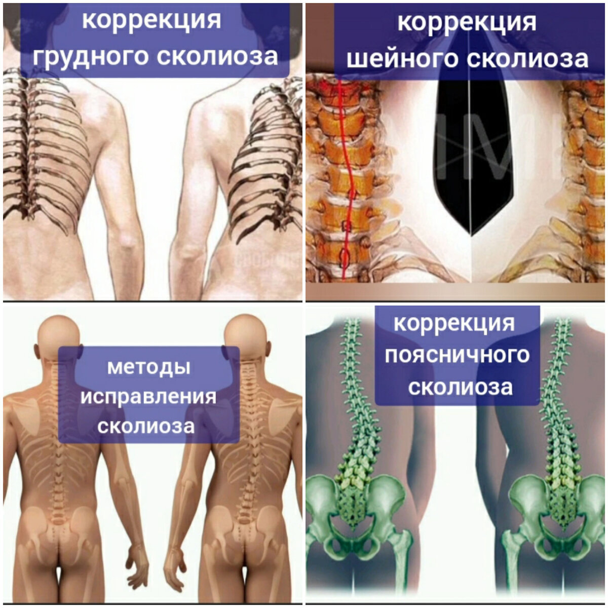 Заболевания передающиеся половым путем. Или чем опасен оральный и незащищенный секс?