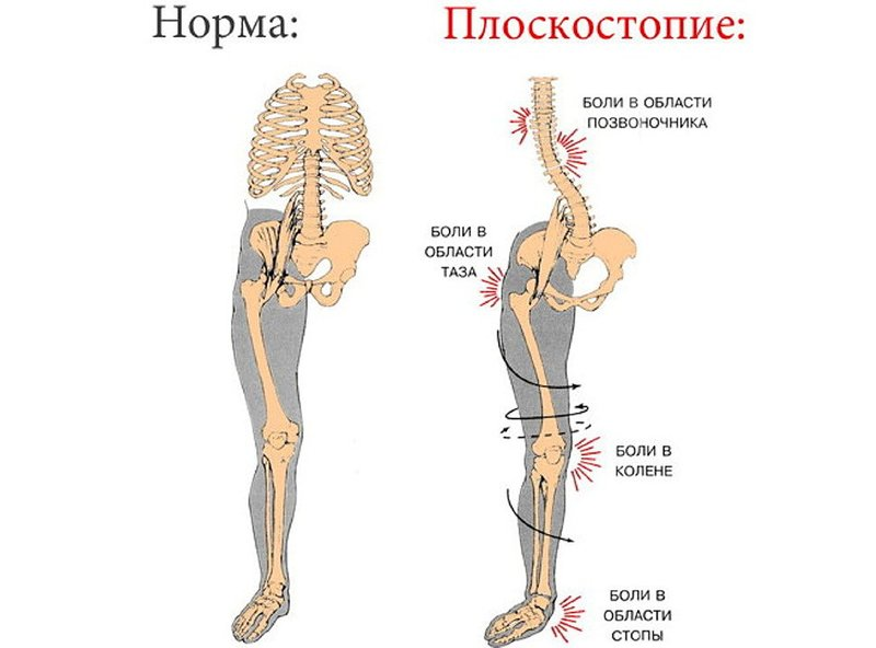 Что любит Ваш позвоночник?