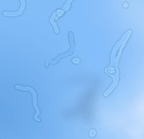 Компьютерная симуляция Muscae volitantes. Оригинал фото из Википедии.