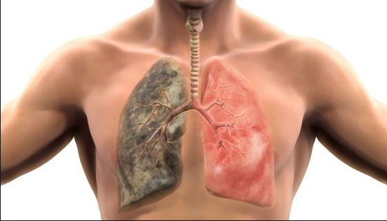 Лёгкие курильщика