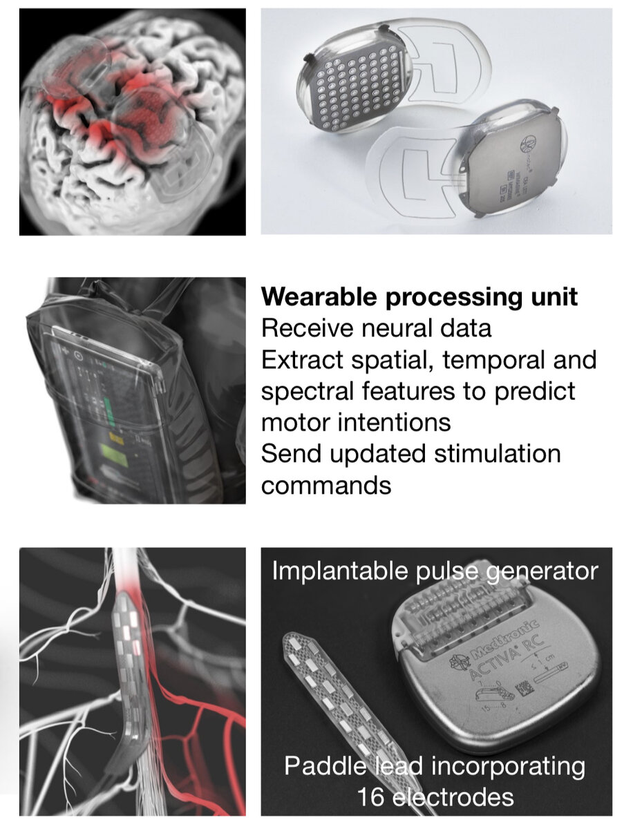     Сверху — кортикальные имплантаты, посередине — носимый процессор, снизу — спинномозговой имплантат и генератор импульсов Henri Lorach et al. / Nature, 2023