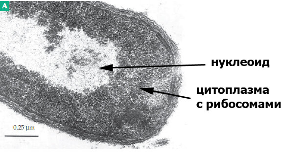 Фотография фрагмента бактериальной клетки с нуклеоидом, полученная методом электронной микроскопии