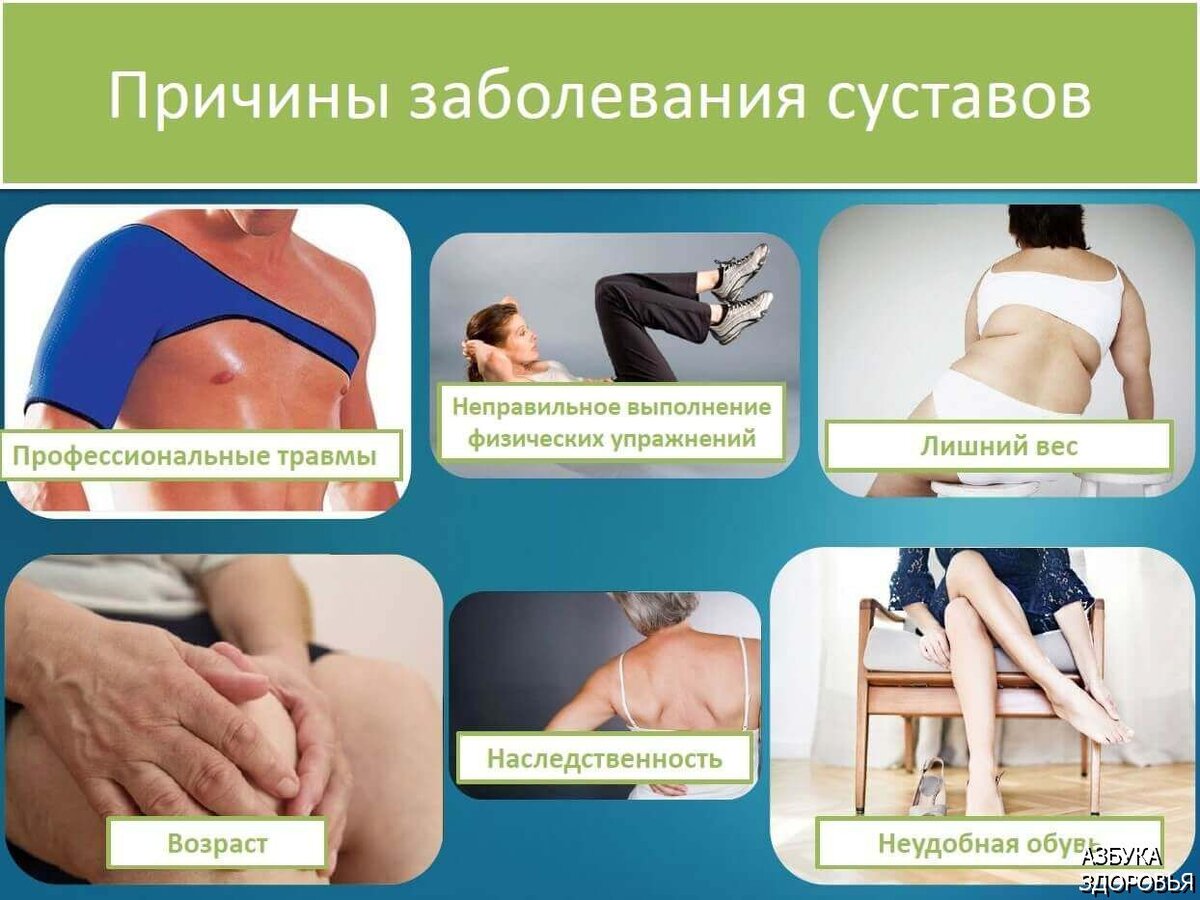 Профилактика ортопедических болезней презентация