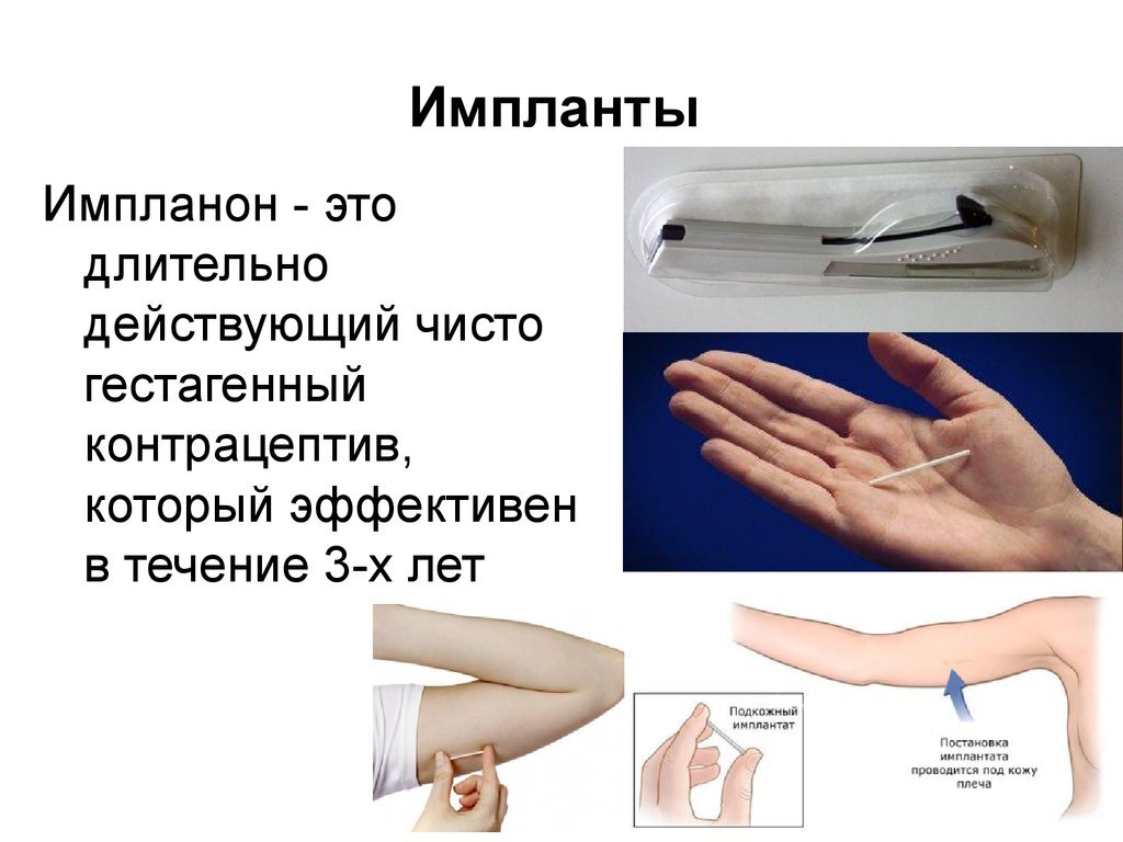 Шарлатаны от медицины: ДОКТОР ЛЕДЕНЕЦ