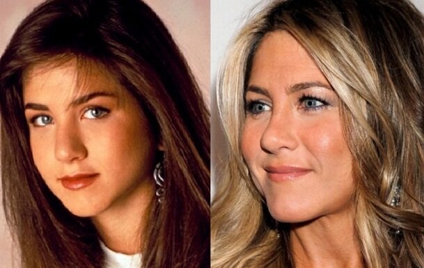 Дженнифер Энистон до и после пластики
