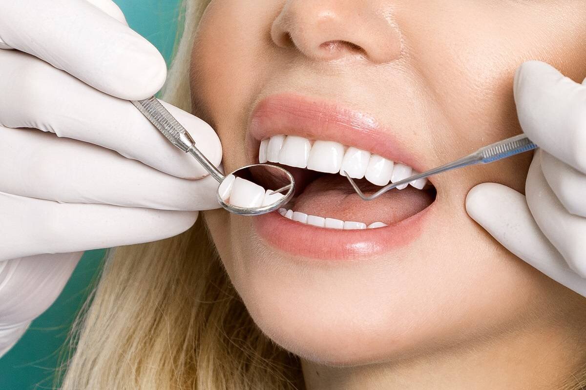 Красивые зубы. Зубы стоматолог. Эстетическая стоматология. Профессиональная гигиена полости рта и зубов. Гигиена десен