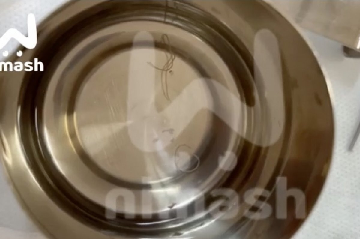    11-сантиметрового червя носил в своей щеке нижегородец