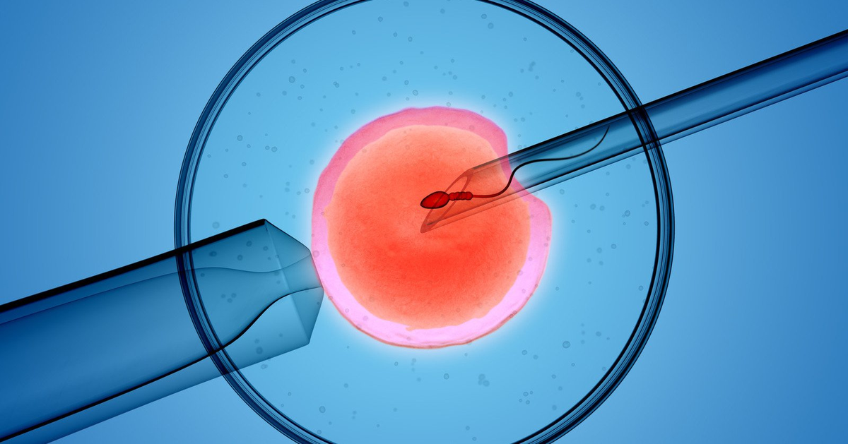 Иллюстрация искусственного оплодотворения