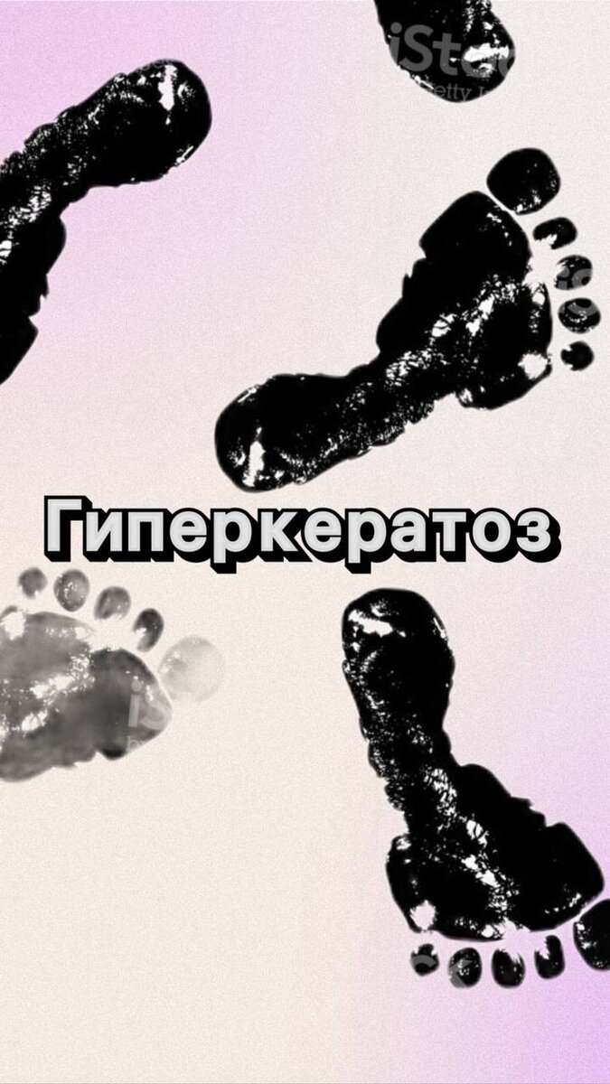 - проблема, которая проявляется избыточным ороговением и утолщением эпидермиса в области подошвы.