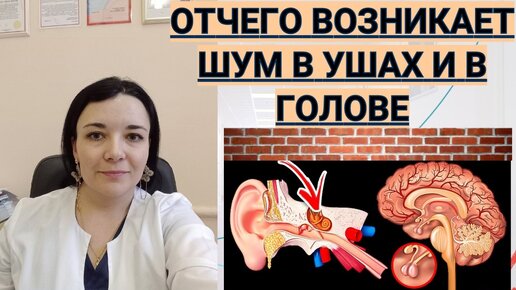 Tải video: Почему возникает шум в ушах и в голове