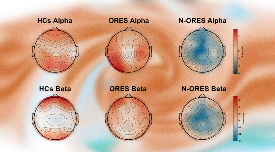   Коллаж N + 1. Источник: Qiuyou Xie et al. / Frontiers in Neuroscience, 2023