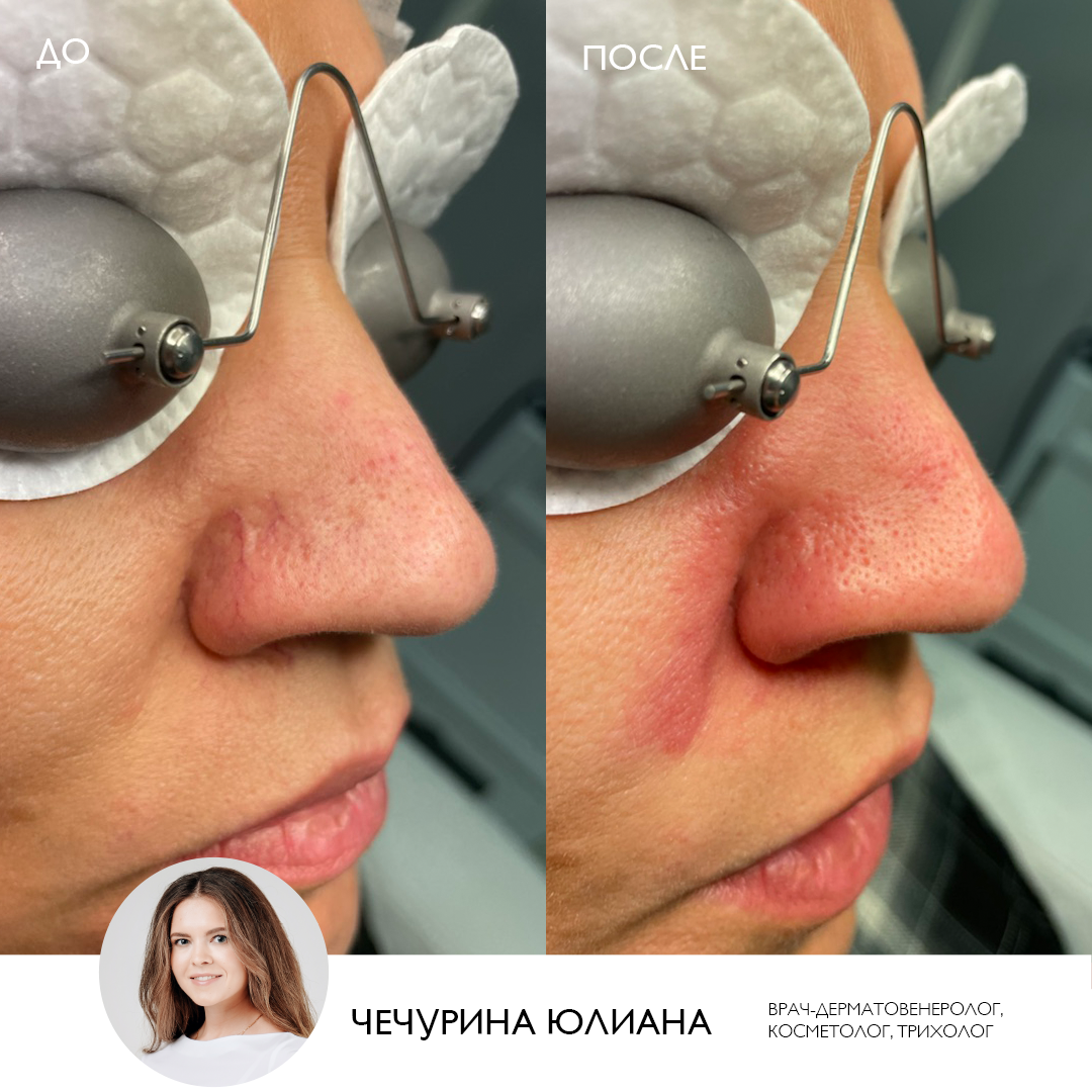 Работы доктора клиники ЭСТЕЛАБ